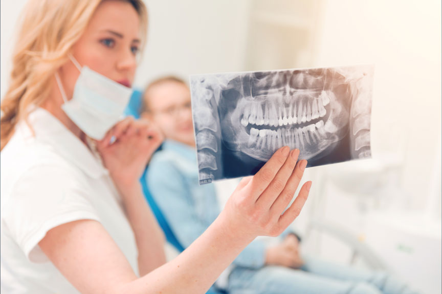 Do You Have to Get Your Wisdom Teeth Removed? Here's What You Need to Know