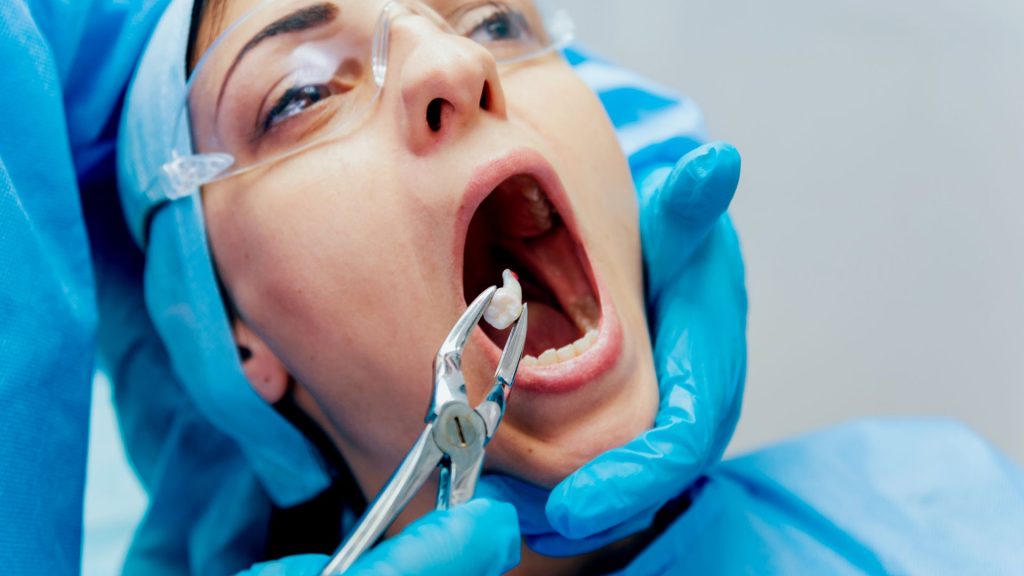 Woman Undergoing Wisdom Tooth Extraction Procedure