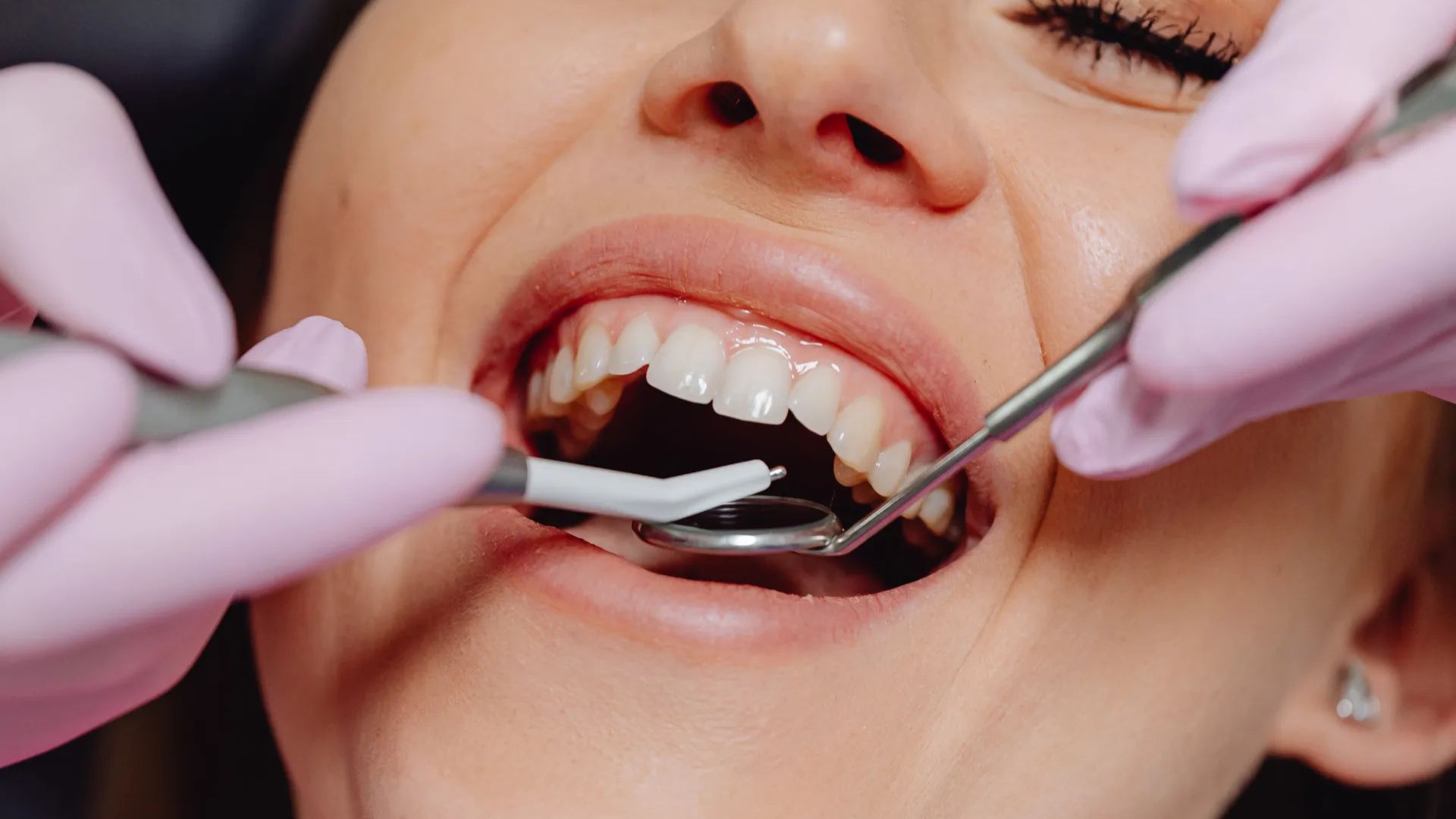 Why Dentists Warn About Gum Disease and Obesity