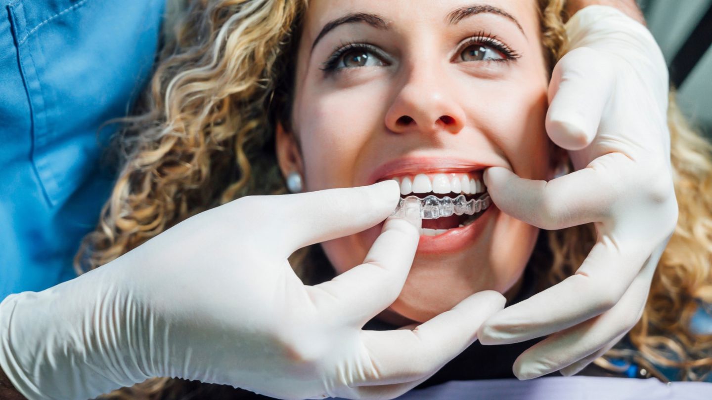 3 Essential Aligner Cleaning Habits for Busy Schedules